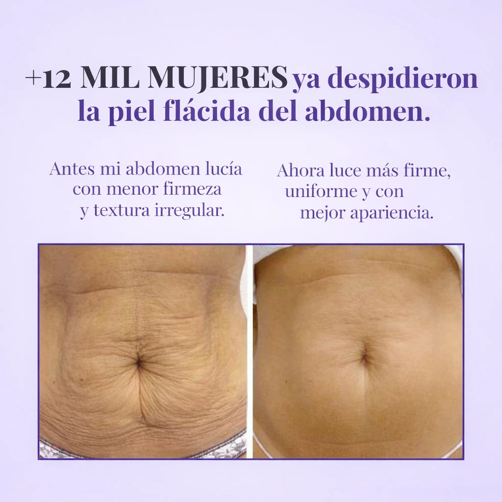 Lyviana® - Reafirma y combate la Flacidez Abdominal
